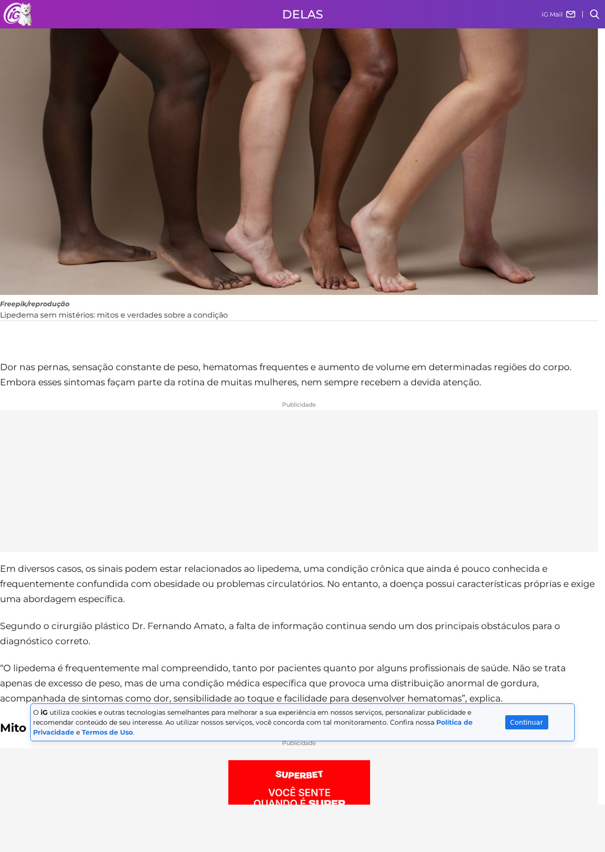 Captura da seção 'Mito ou verdade?' da matéria do iG Delas sobre lipedema