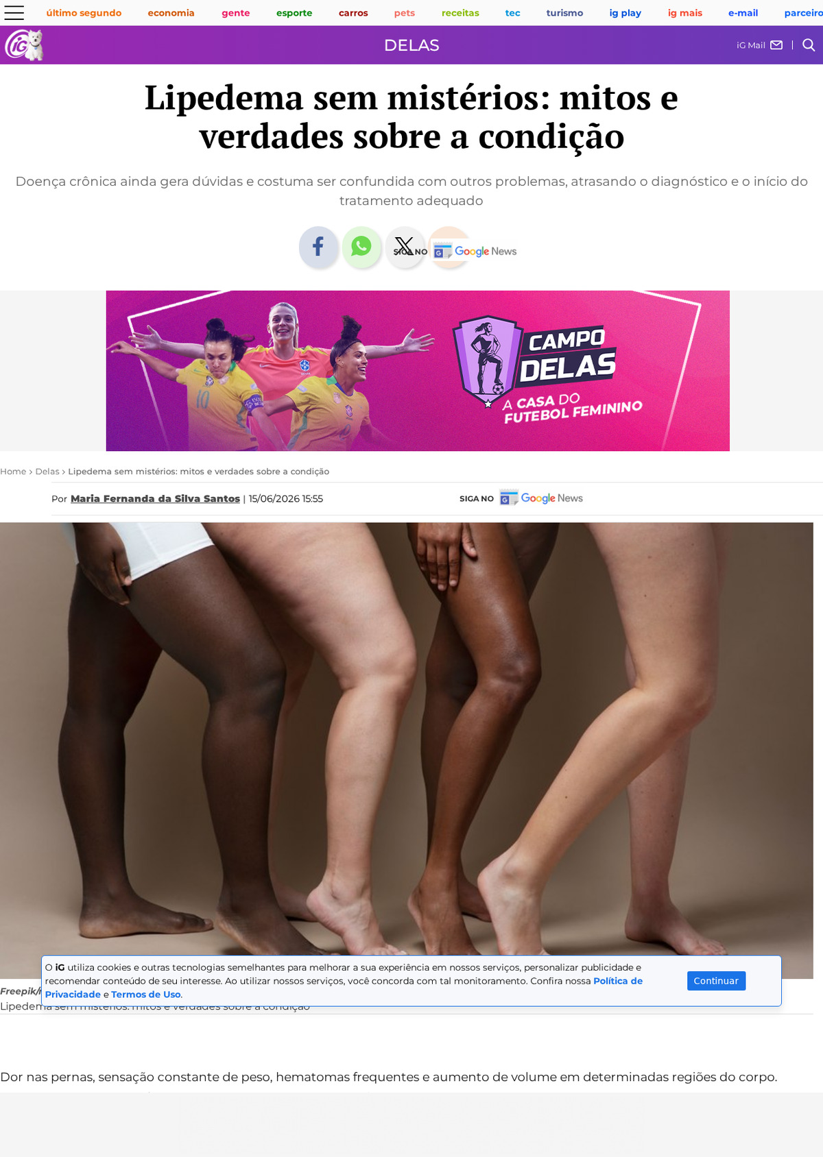 Captura da página inicial da matéria 'Lipedema sem mistérios: mitos e verdades sobre a condição' publicada na editoria Delas do portal iG, com declarações do Dr. Fernando Amato