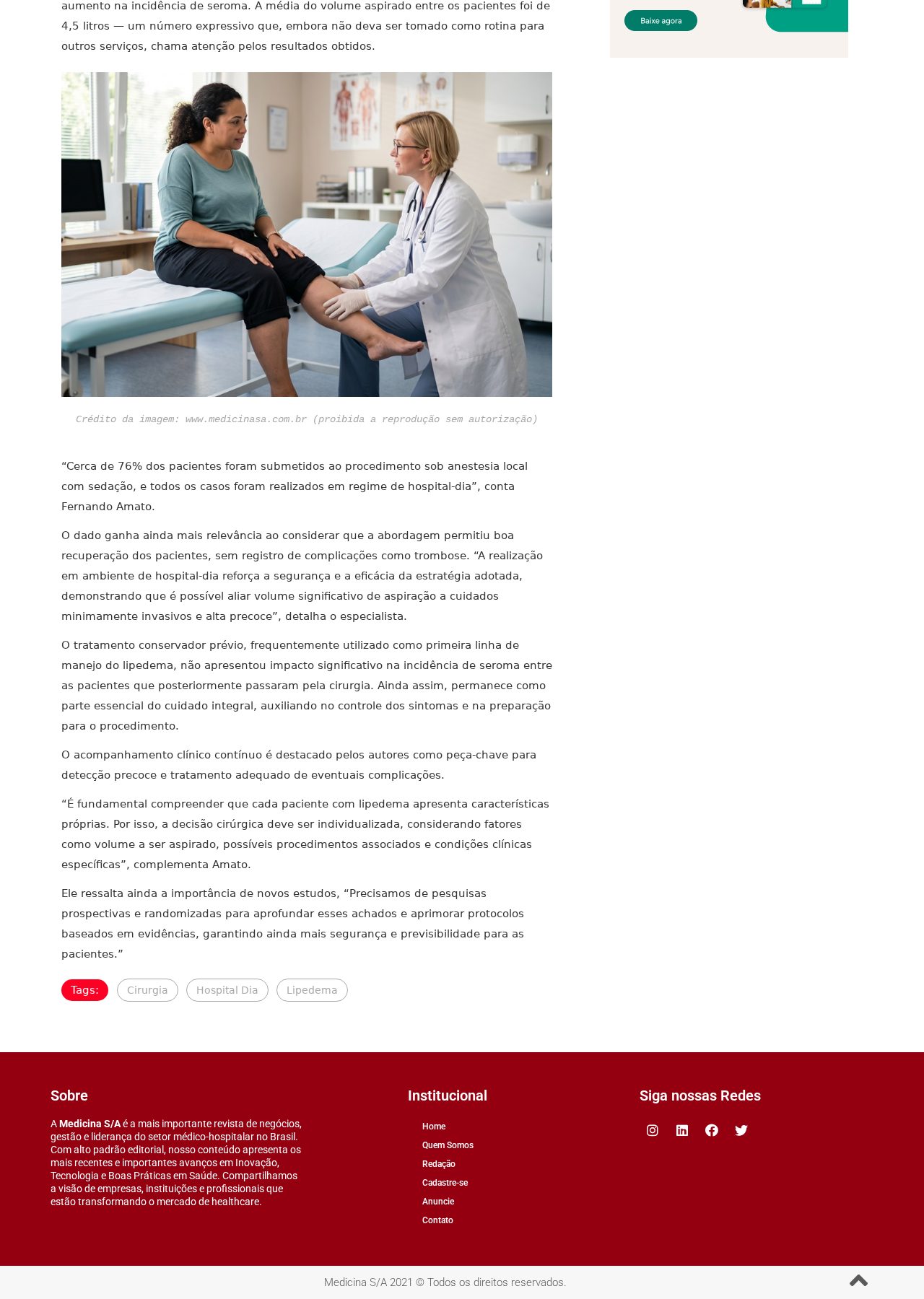 Trecho da reportagem da Medicina S/A com declarações do Dr. Fernando Amato sobre cirurgia para lipedema em hospital-dia