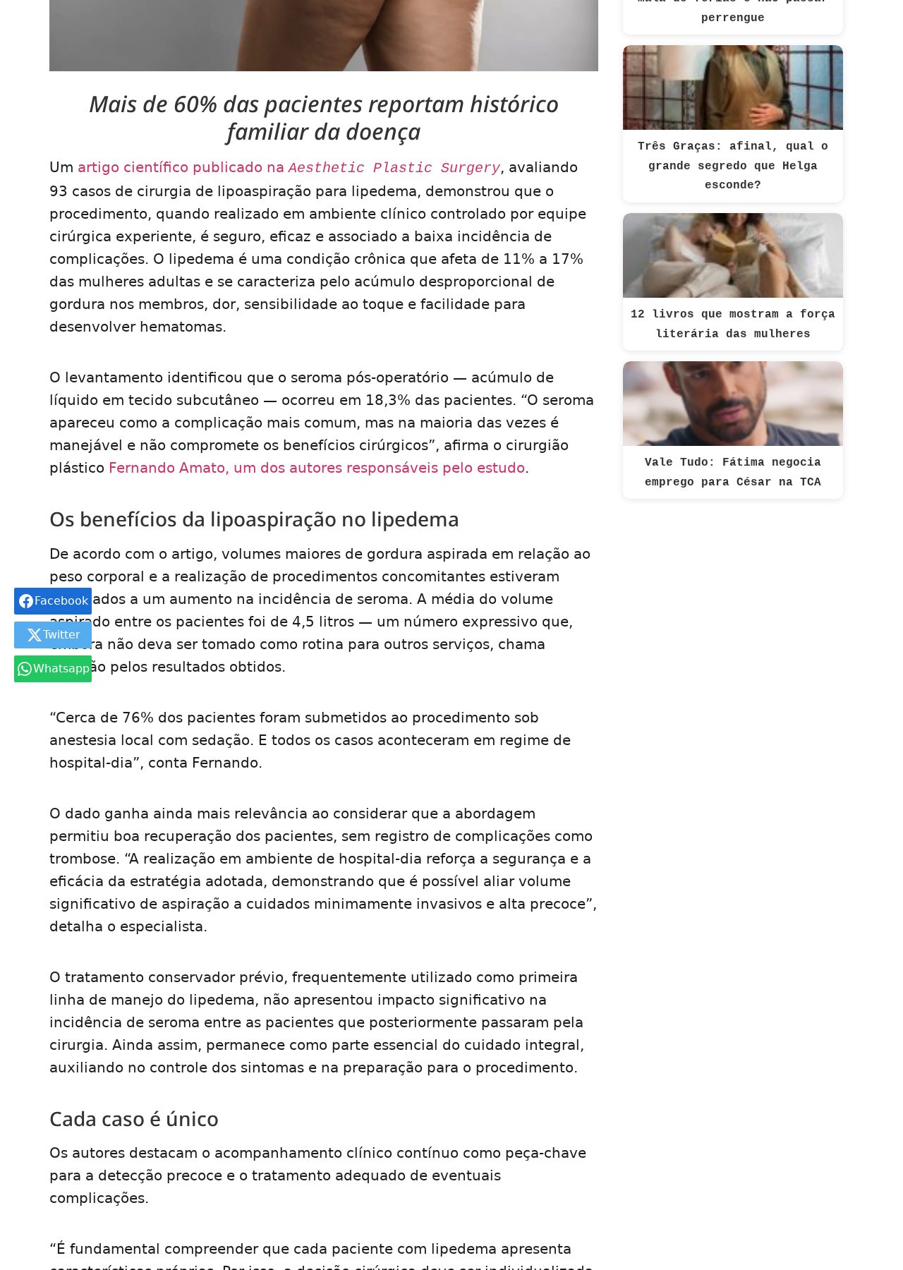 Trecho da matéria da Revista Malu com declarações do Dr. Fernando Amato sobre lipoaspiração para lipedema em hospital-dia